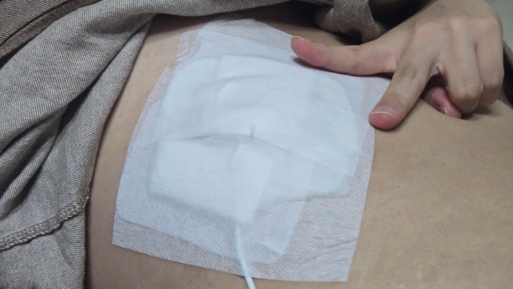  담낭제거 후유증부터 해결까지 PCD PTBD 후기와 팁