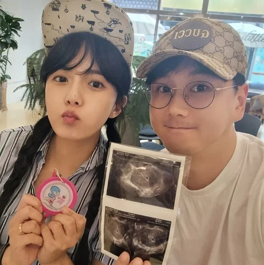 <b>강은비</b>, 40세에 결혼 3개월 만 <b>자연임신</b> 소식 전해…태명은... 