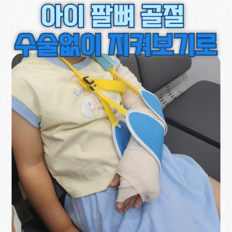  아이 팔뼈(팔꿈치뼈) 골절 수술 없이 지켜보기로 / 보험 실비 보상 기록