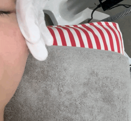  대구피부관리 유스에스테틱 황금점 후기