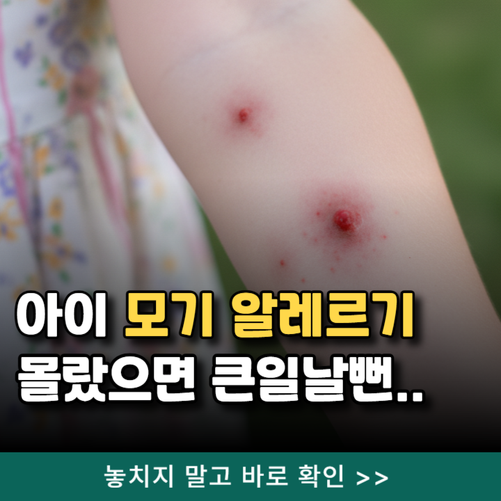  아이 모기 알레르기 증상은? 몰랐으면 큰일날뻔.. (병원 내과 약국 총정리)