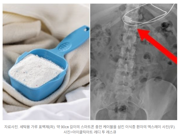  "표백제 맛있어" 혀로 핥던 30대 여성…정체는 ‘이식증’ 
