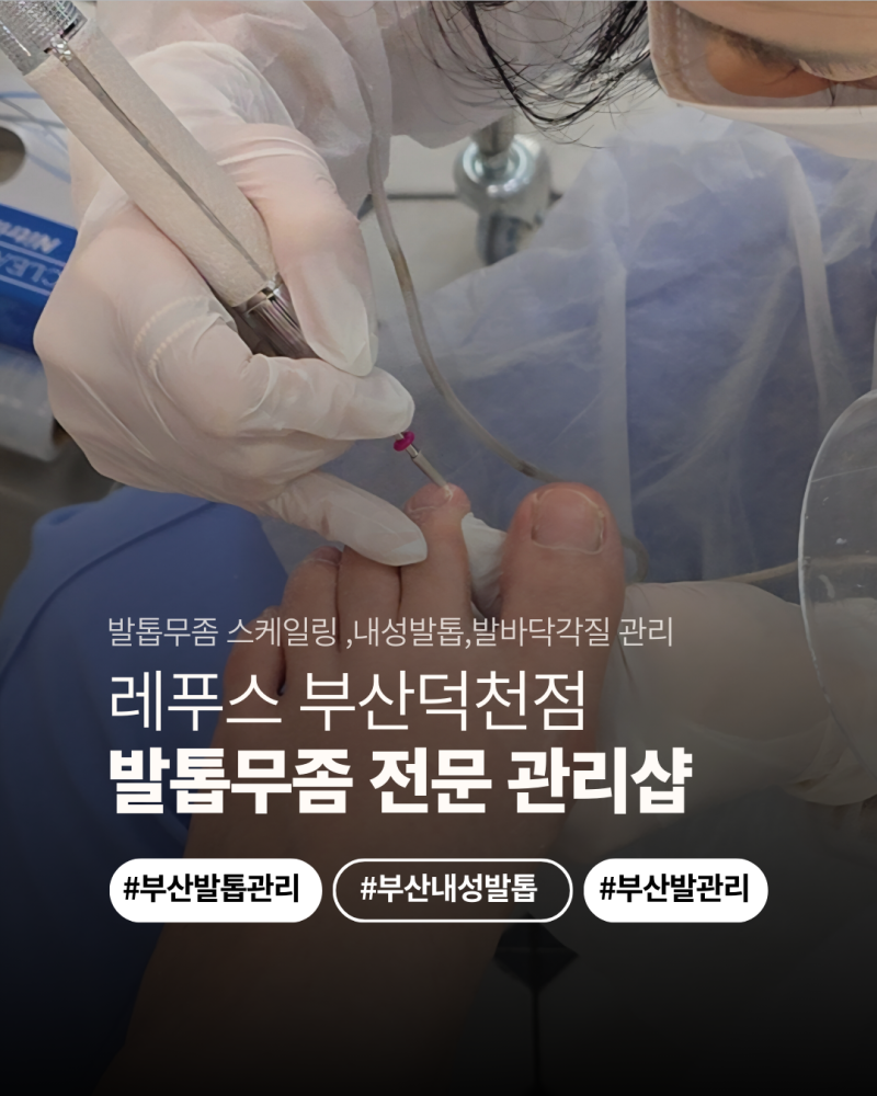 부산 발톱무좀 케어 잘하는 곳 레푸스 부산덕천점 에서 제대로 관리받자