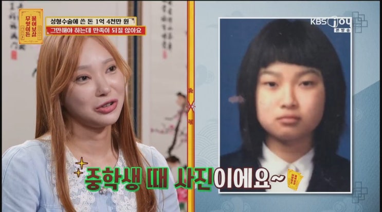 서장훈 성형으로 1억 4천만 원 쓴 사연녀에게 부자연스러워 일침 물어보살