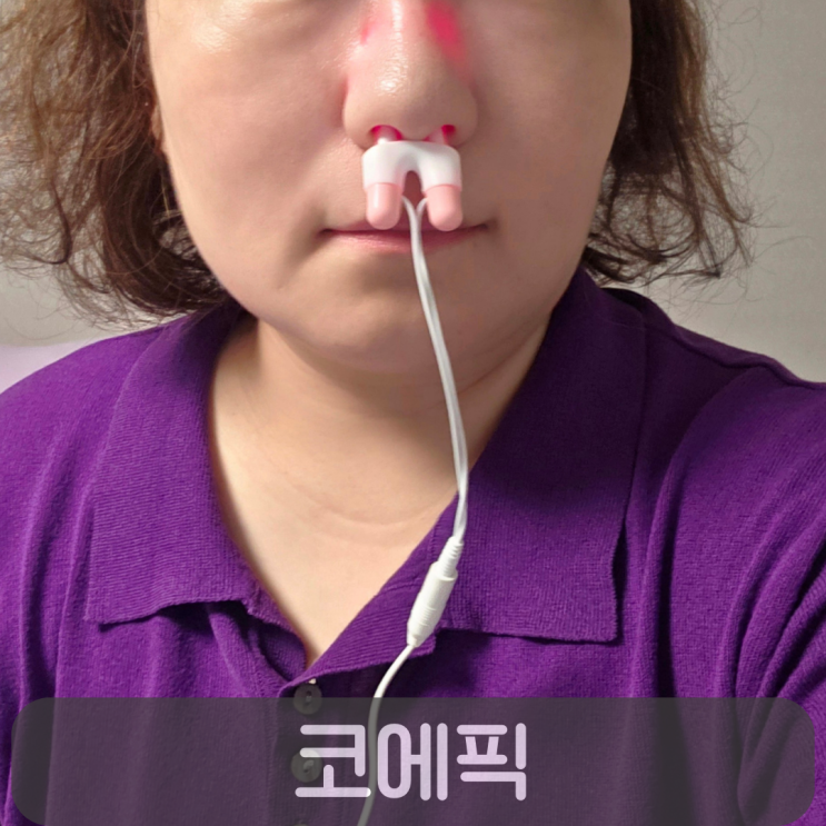  비염치료기 내돈내산 솔직 후기, 감기 노란 콧물 달라졌어요!