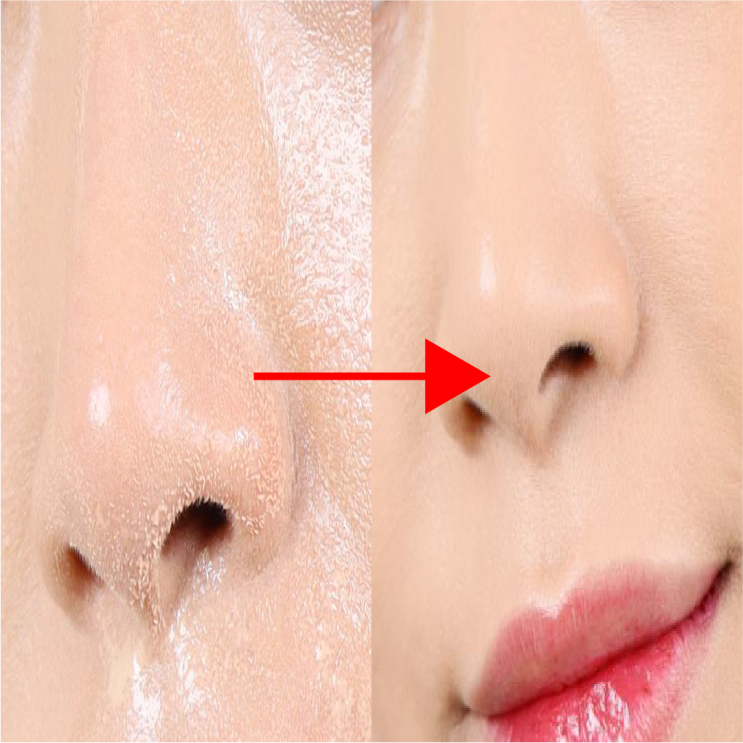  머리에 땀 많은 사람 이거만