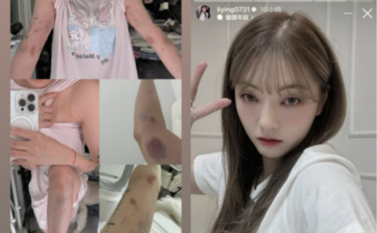 <b>폭행</b>이었다".."원나잇 거절했더니 <b>폭행</b>당해" <b>대만</b>여성 사건
