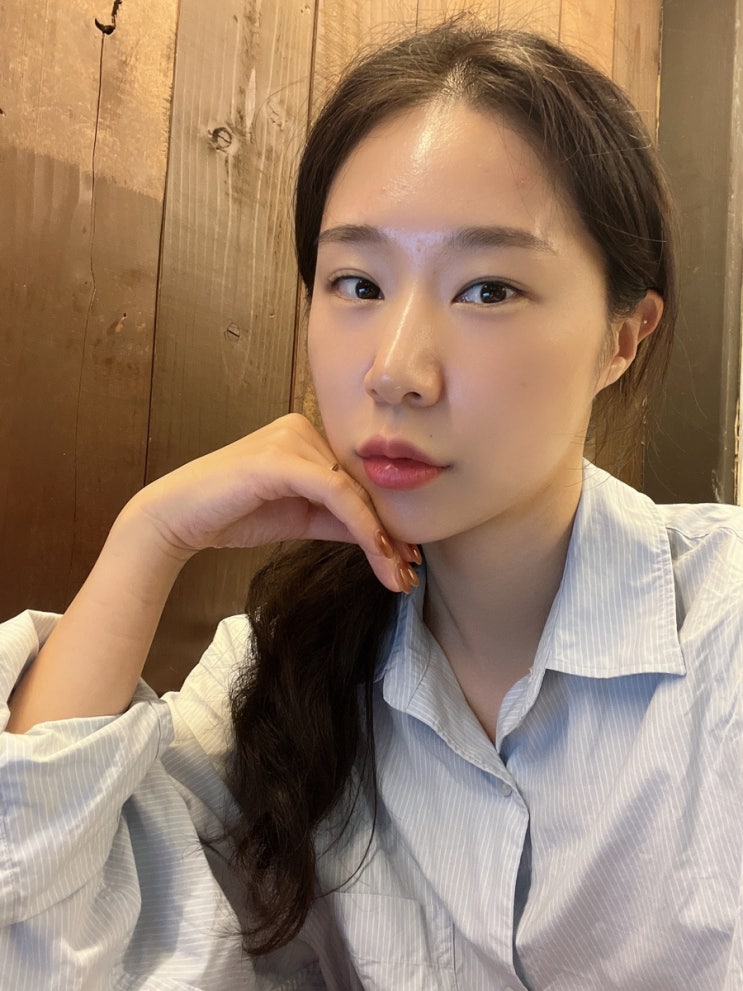  부천피부과 입술필러, 입꼬리보톡스 잘하는곳 2cc(2주 후기)
