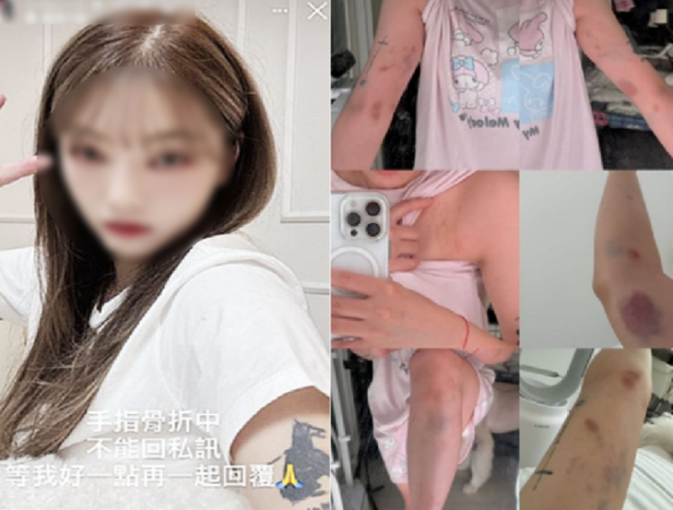 [속보]홍대 <b>대만 유튜버 폭행</b> 사건, 한국인 가해자 확인 후 경찰... 