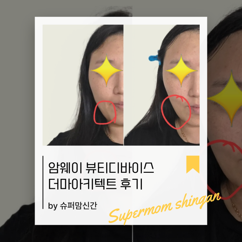암웨이 더마아키텍트 후기