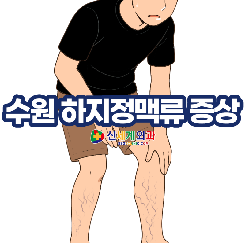 수원 하지정맥류, 외과 전문의가 알려주는 치료법 총정리