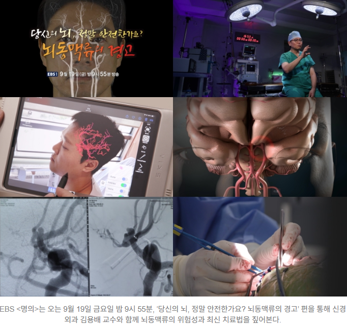  뇌 속 시한폭탄 ‘뇌동맥류’ ️ 조기 발견이 생사를 가른다