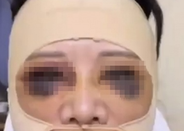  “예뻐지려다 판다 됐다” 80조원 중국 성형 시장의 민낯