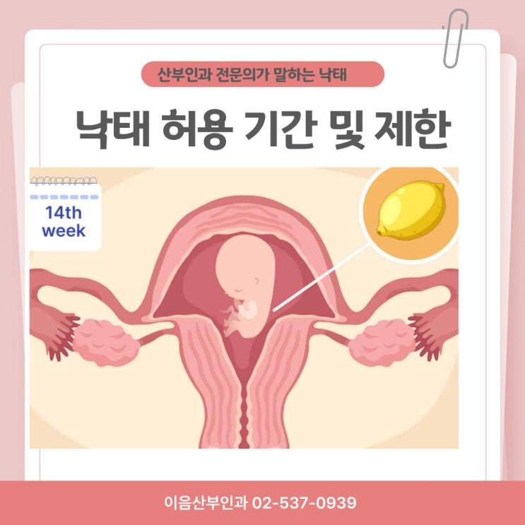  낙태 수술 시간과 낙태 합법화 시기 기간