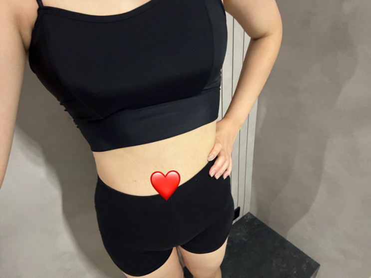  마운자로 가격 처방 용량 식욕억제제 후기 -13kg
