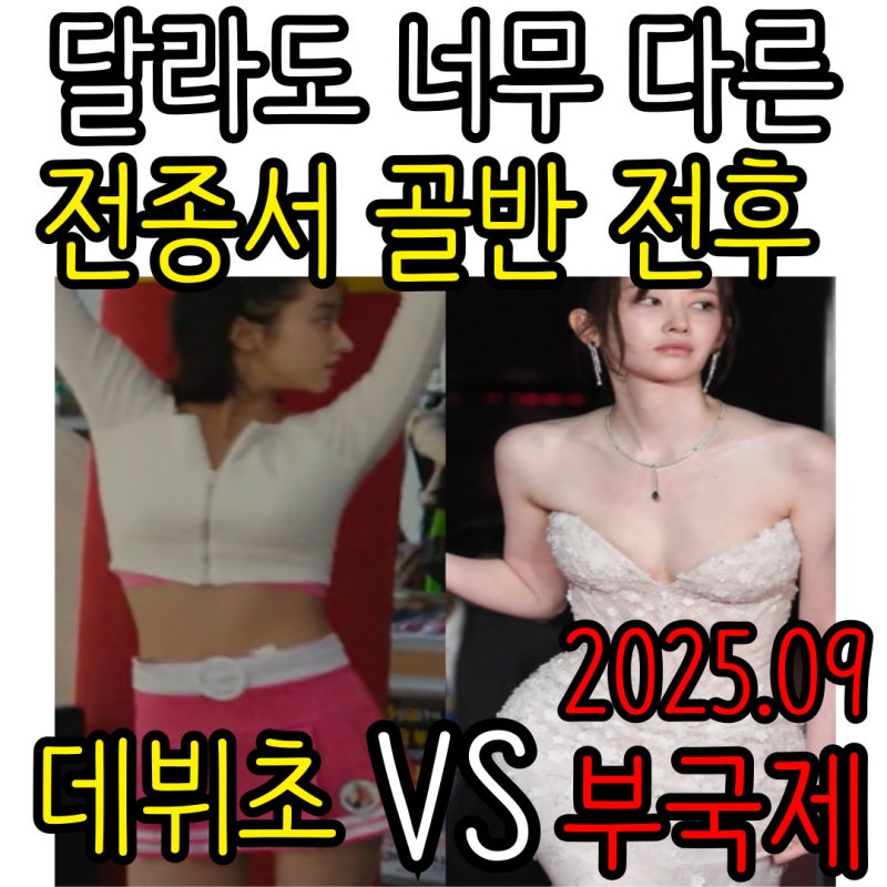 수술, 필러 논란 일으킬만큼 데뷔초와는 너무 다른 전종서 골반 전 후 비교해보기