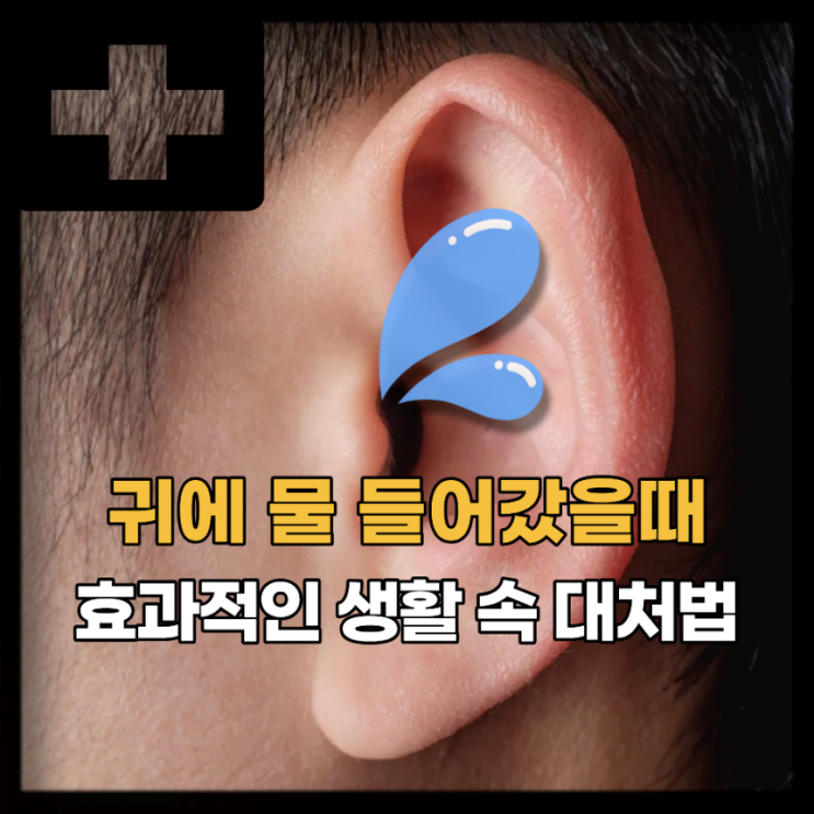  귀에 물빼는법 이비인후과 안가고 귀에 들어간 물 빼는법 5가지