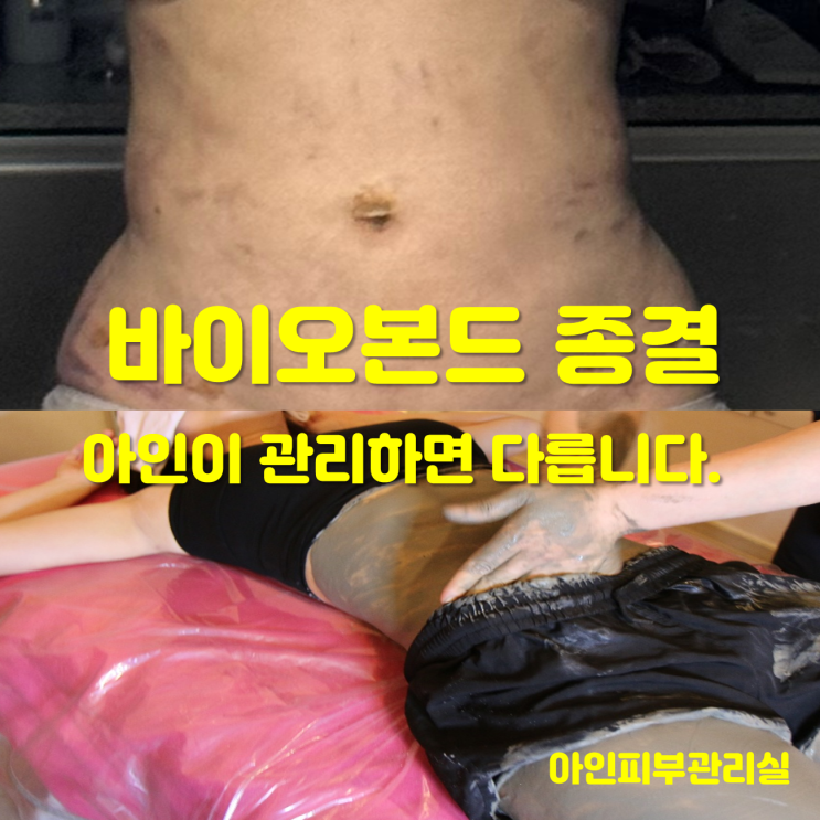  천안 두정동 피부관리 신부동 바이오본드 바본 관리의 진심 아인피부관리실입니다.