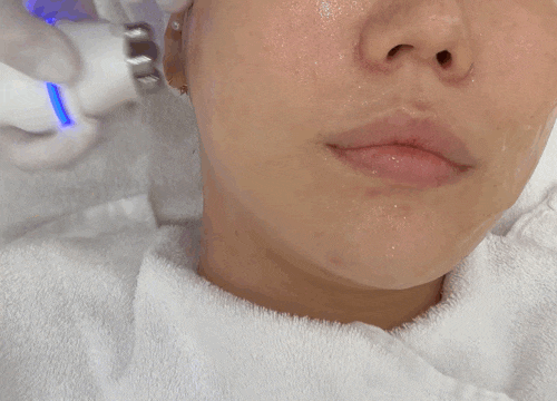  환절기 분당 피부관리 분당페이스핏톡스 by 뷰티디안느