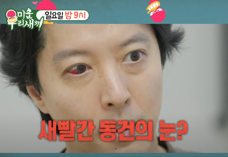 조윤희 전 남편 <b>이동건</b>, <b>희귀병</b> 진단 고백..새빨간 눈의 정체는?