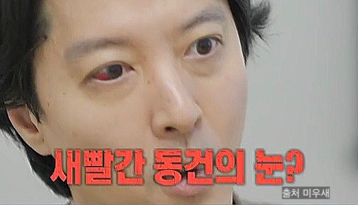 <b>이동건 희귀병</b> 병명 진단 증상 원인 무슨일 미우새