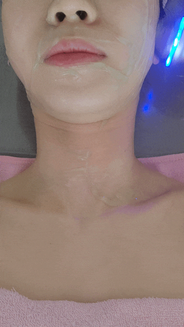  물방울리프팅 효과 및 솔직후기 소노셀 트리플 리프팅 관리 인천논현 피부관리 소녀피부