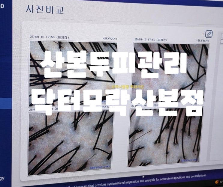  [경기 군포] 편안한 맞춤형 관리 산본두피관리 닥터모락산본점