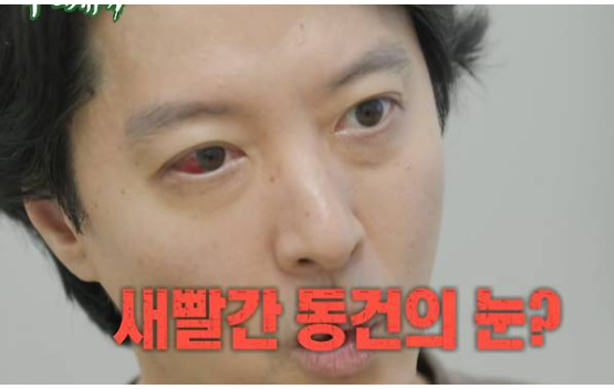 <b>이동건</b>, '이혼 후' 1% <b>희귀병</b> 진단..."송곳으로 찌르는 느낌... 