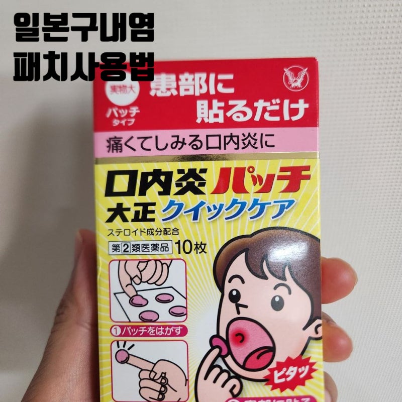 일본 구내염 패치 다이쇼 사용법 효과 후기 잘 붙이는 법