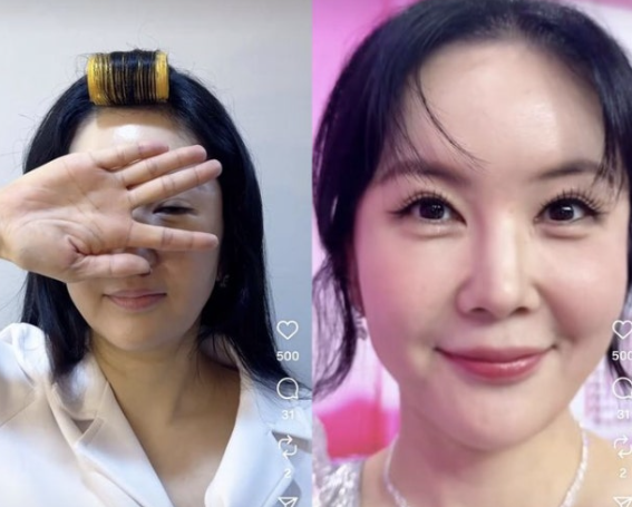  "장영란", 서클렌즈 뺀 美 공개  “47세 맞아? 동안 미모 실화” [성형고백]