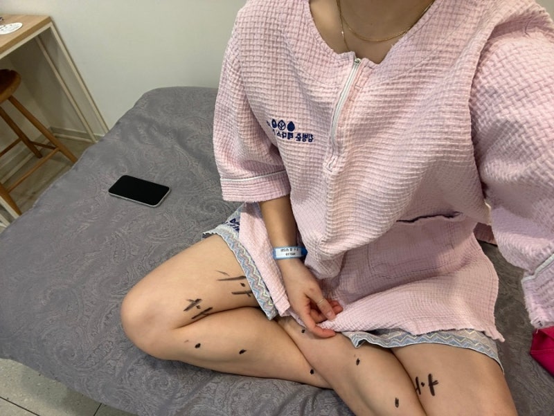 [부산/서면] 김병준 레다스 흉부외과 의원 : 겉으로 티나지 않는 20대 후반 하지정맥류 찐수술....