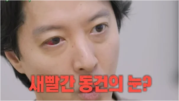  이동건 매일 송곳으로 찔리는 고통 1% 희귀병 (미우새)