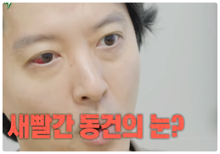 이동건 희귀병 충격 진단 미우새 예고 숨겨왔던 고통의 병명 실체는?