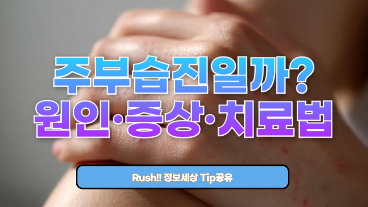  손가락 사이사이 가려움, 주부습진일까? 원인·증상·치료법 총정리