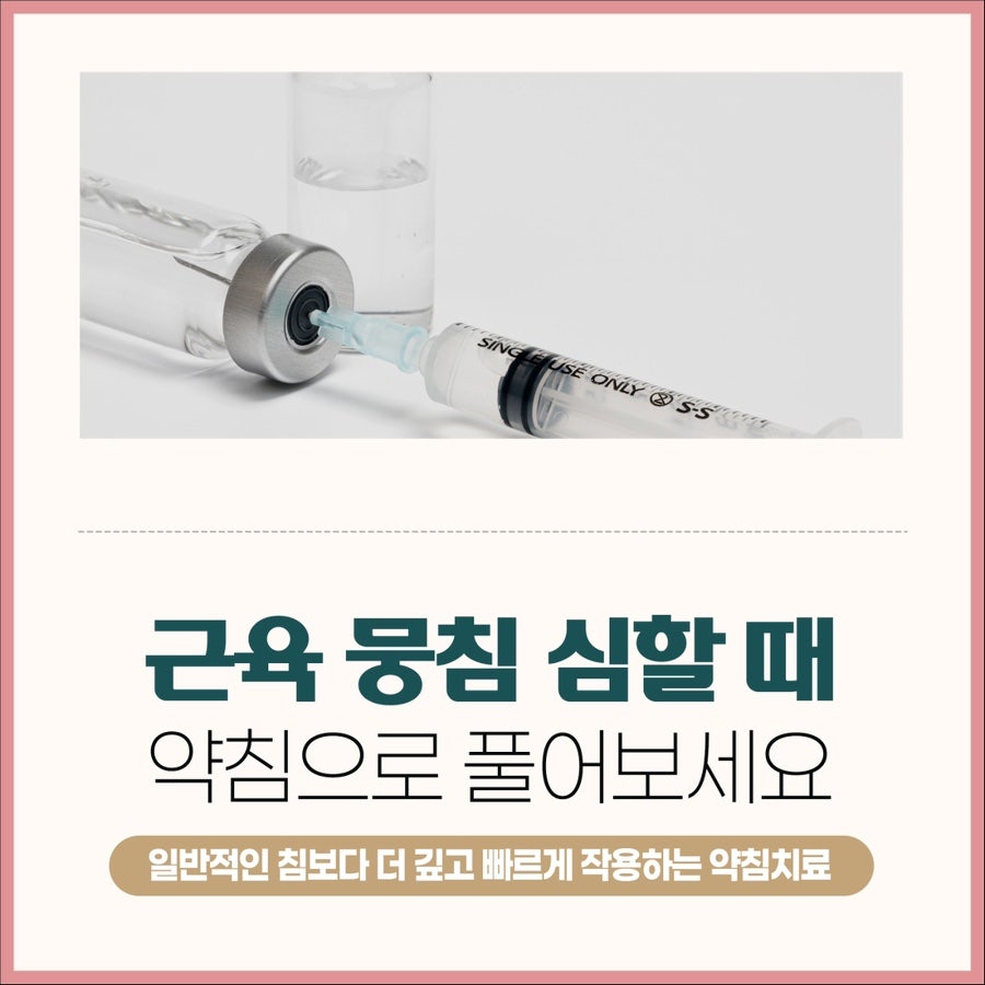 근육 뭉침 심할 때 약침으로 풀어보세요