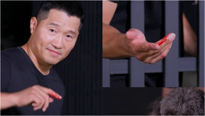 강형욱 개물림 사고 당했다 손에 피가 철철 '안락사 시켜야 하나' (개늑시)