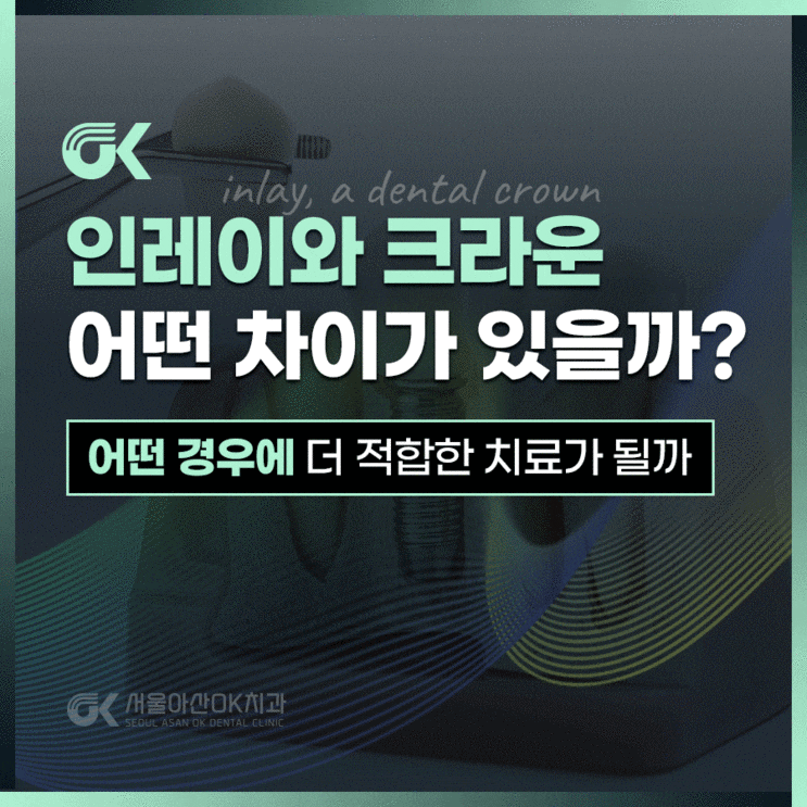  미사 충치치료 인레이와 크라운 차이점