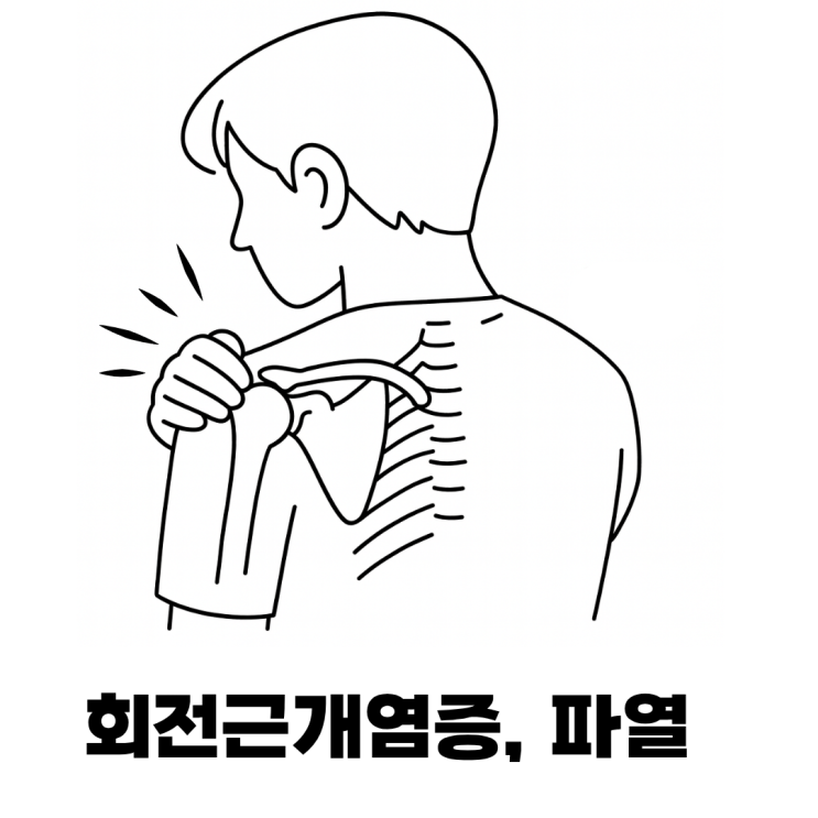  어깨에서 ‘뚝’ 소리? 회전근개 파열일 수 있어요!