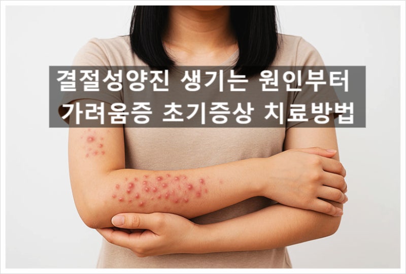 결절성양진 생기는 원인부터 가려움증 초기증상 치료방법/기간