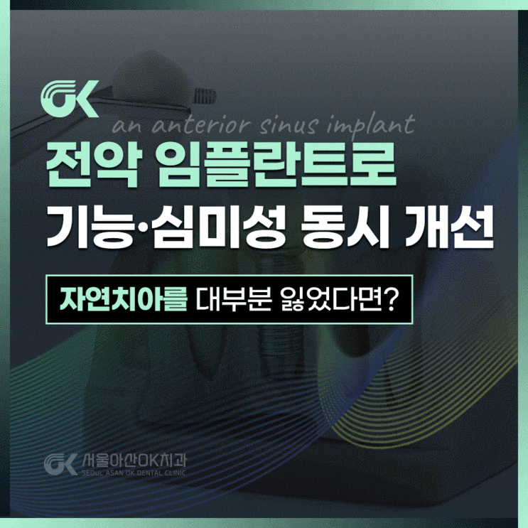  미사역 치과, 틀니 대신 전악 임플란트가 필요한 이유