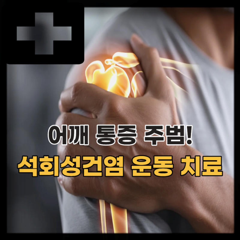어깨 석회성건염 원인 증상 치료에 도움되는 스트레칭 (석회화건염)