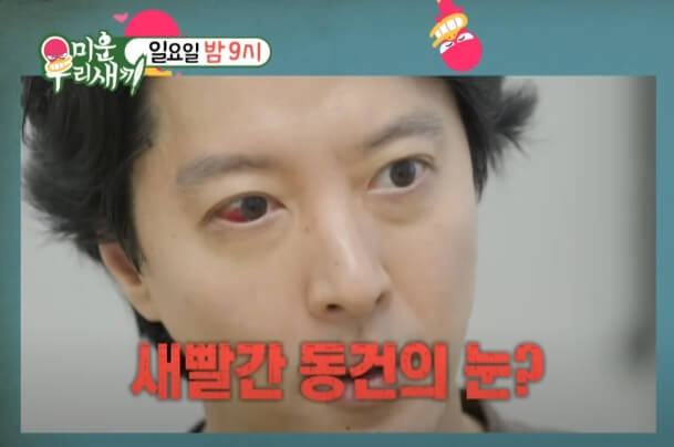  강직성 척추염 이동건 희귀병 증상과 치료방법은?