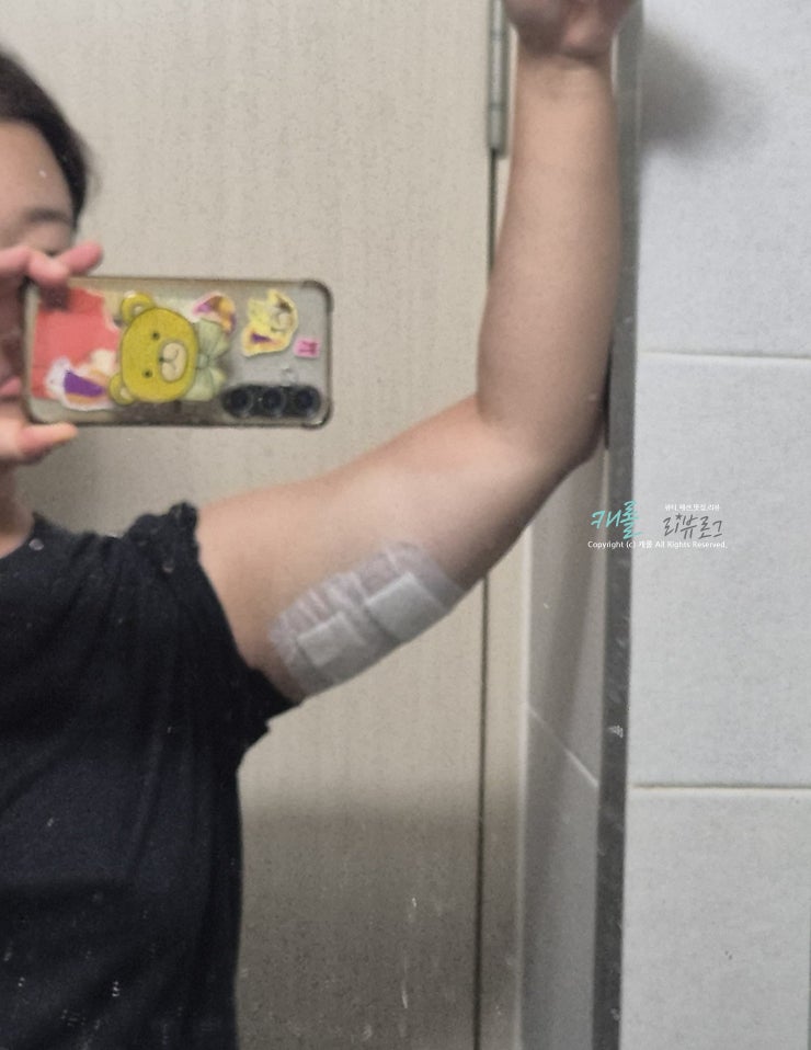 인천 연수구 다이어트 의원 대용량 지방분해주사 후기