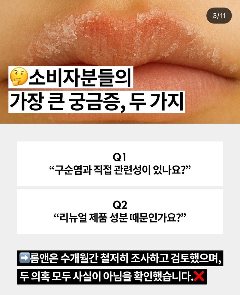 롬앤 구순염 논란? 쥬시 래스팅 틴트, 적색 202, 증상 등 정리해봄