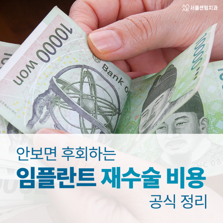  임플란트재수술비용 무시하고 관리 안하다가는 안보면 후회 비용공식 정리