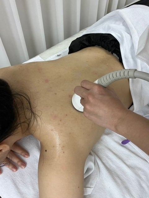  공덕 피부보기(skin biew)에서 등드름 관리 받은 100% 솔직 후기