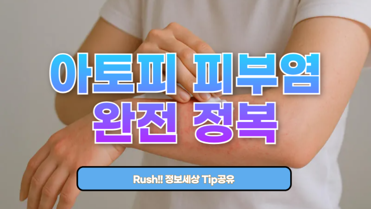  아토피 피부염 완전 정복: 원인부터 치료법, 예방까지