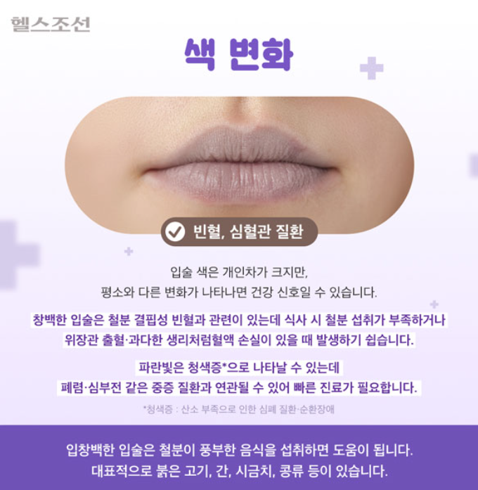   “입술이 보내는 위험 신호 4가지” 그냥 넘기면 큰일날 수도 있다!