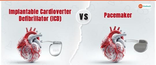 인공심박동기(Pacemaker)와 삽입형 제세동기(ICD) 이해와 간호 관리