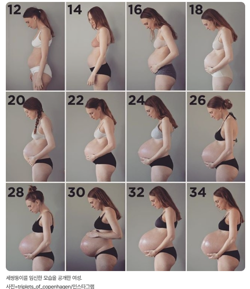  포동포동 ‘거대아’ 증가  귀엽지만 숨은 건강 경고